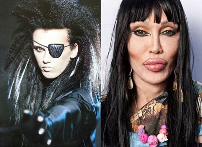 pete_burns_antesydepsues