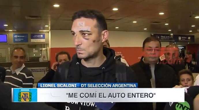 scaloni--en-su-llegada-a-argentina-tras-sufrir-un-accidente-con-su-bicicleta--espn