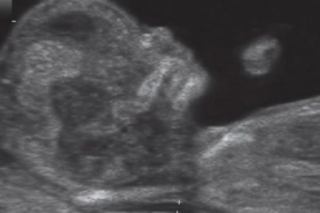 week-12-scan-1