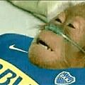simian